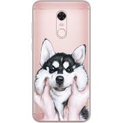 Прозрачный чехол Uprint Xiaomi Redmi 5 Plus Husky