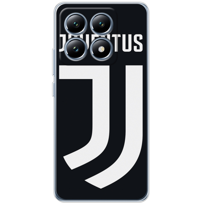 Чохол BoxFace Xiaomi 14T Pro FC J