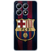 Чохол BoxFace Xiaomi 14T Pro 