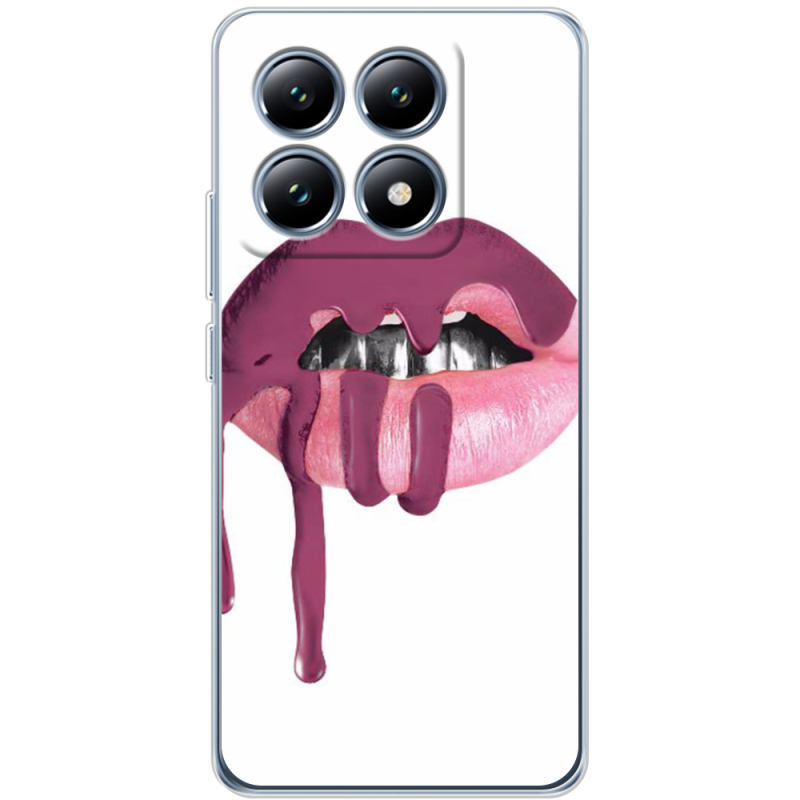 Чохол BoxFace Xiaomi 14T Pro 