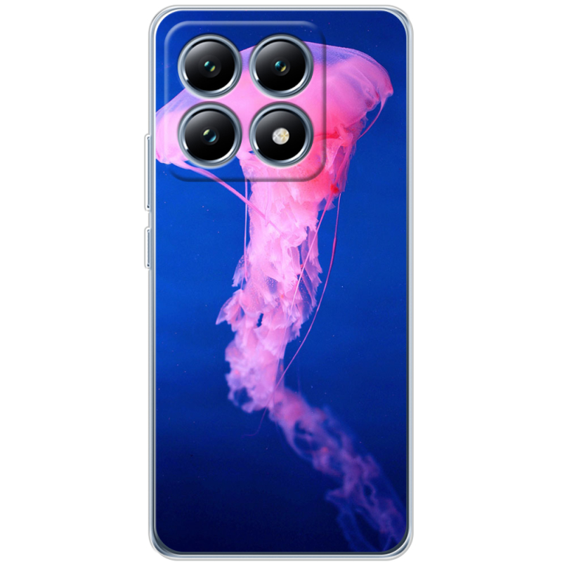 Чохол BoxFace Xiaomi 14T Pro 