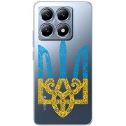 Прозорий чохол BoxFace Xiaomi 14T Pro Gold Trident