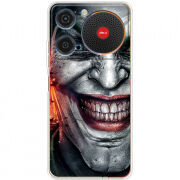 Чохол BoxFace ZTE Nubia Music Prankster