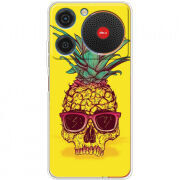 Чохол BoxFace ZTE Nubia Music Pineapple Skull