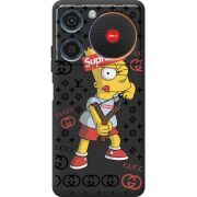 Чорний чохол BoxFace ZTE Nubia Music Yellow Fun