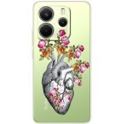 Чохол зі стразами Xiaomi Redmi Note 14 4G Heart