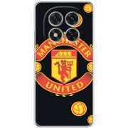 Чохол BoxFace Xiaomi Redmi Note 14 Pro 5G FC Manchester-U