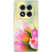 Чохол BoxFace Xiaomi Redmi Note 14 Pro 5G Bouquet of Tulips