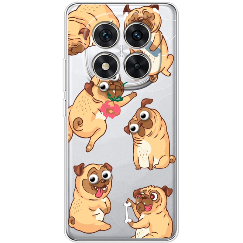 Прозорий чохол BoxFace Xiaomi Redmi Note 14 Pro 5G с 3D-глазками Pug