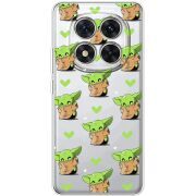 Прозорий чохол BoxFace Xiaomi Redmi Note 14 Pro 5G Pattern Baby Yoda