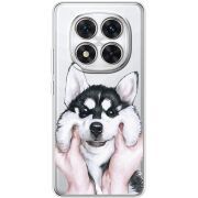 Прозорий чохол BoxFace Xiaomi Redmi Note 14 Pro 5G Husky