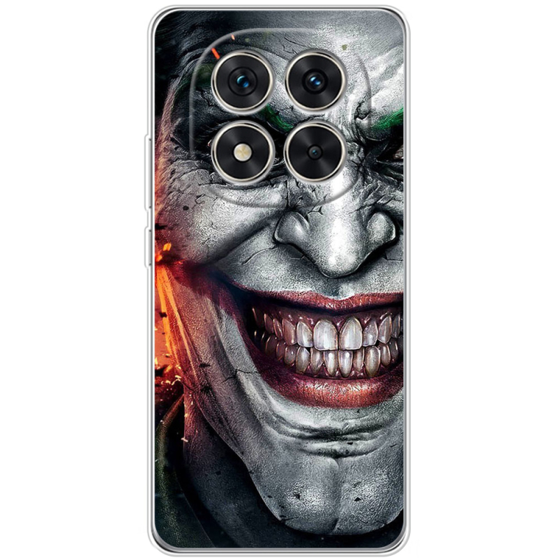 Чохол BoxFace Xiaomi Redmi Note 14 Pro 4G Prankster