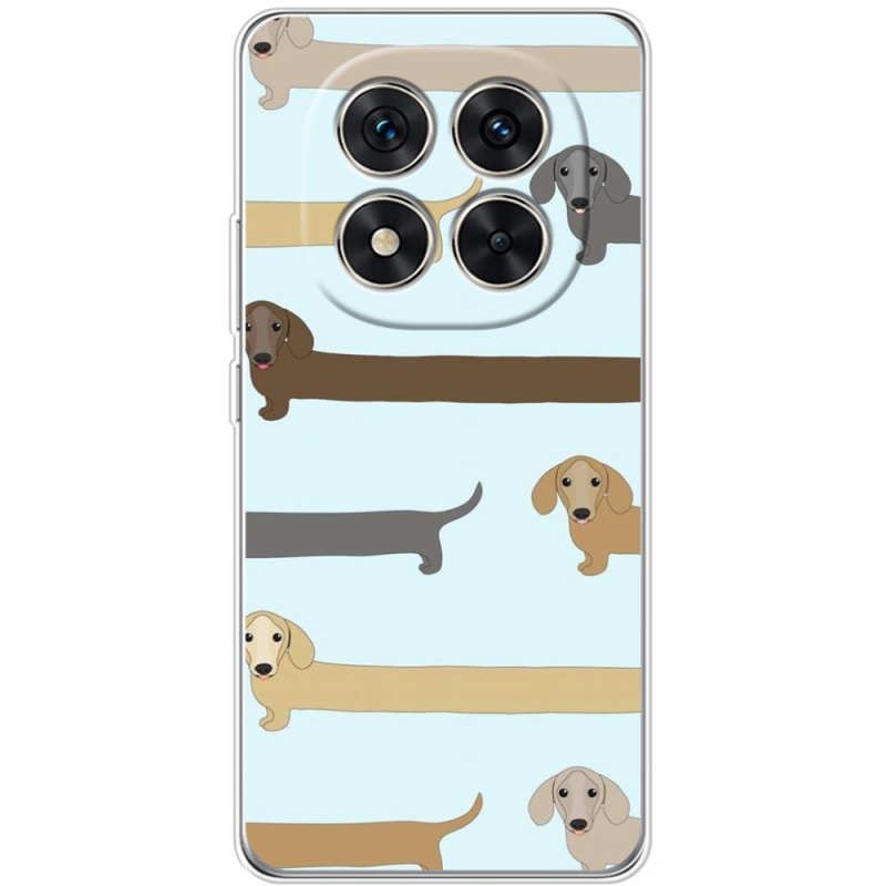 Чохол BoxFace Xiaomi Redmi Note 14 Pro 4G Dachshund