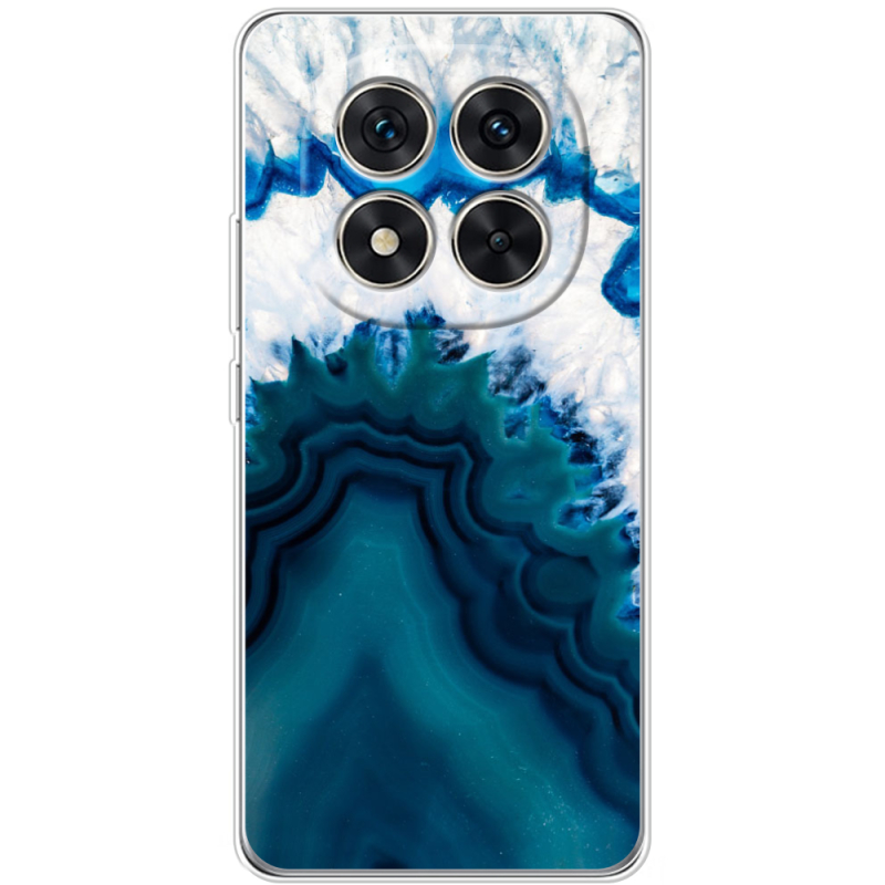 Чохол BoxFace Xiaomi Redmi Note 14 Pro 4G 