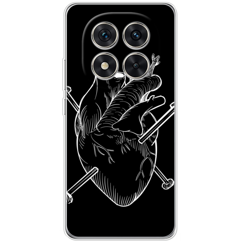 Чохол BoxFace Xiaomi Redmi Note 14 Pro 4G 