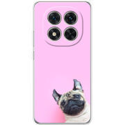 Чохол BoxFace Poco X7 