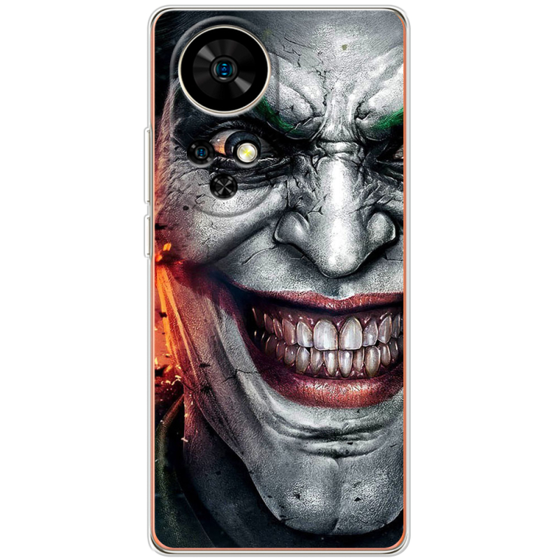 Чохол BoxFace Ulefone Note 17 Pro Prankster