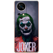 Чохол BoxFace Ulefone Note 17 Pro Joker