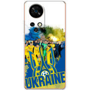 Чохол BoxFace Ulefone Note 17 Pro Ukraine national team