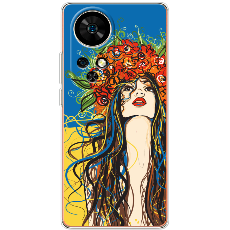 Чохол BoxFace Ulefone Note 17 Pro Ukraine Girl