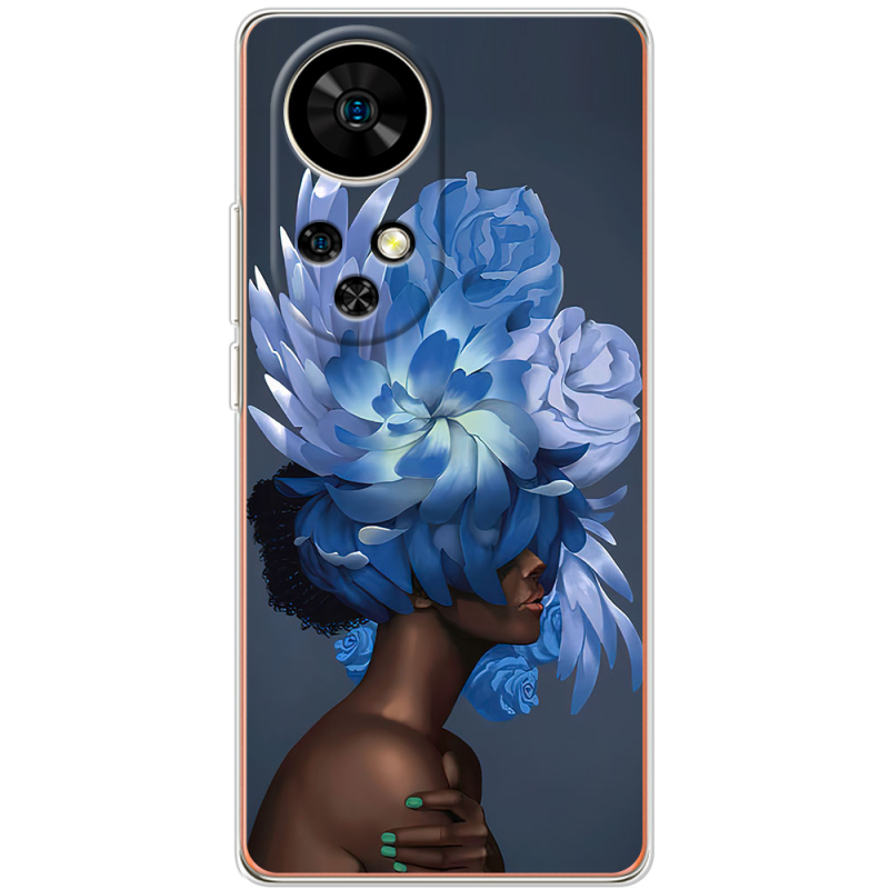 Чохол BoxFace Ulefone Note 17 Pro Exquisite Blue Flowers