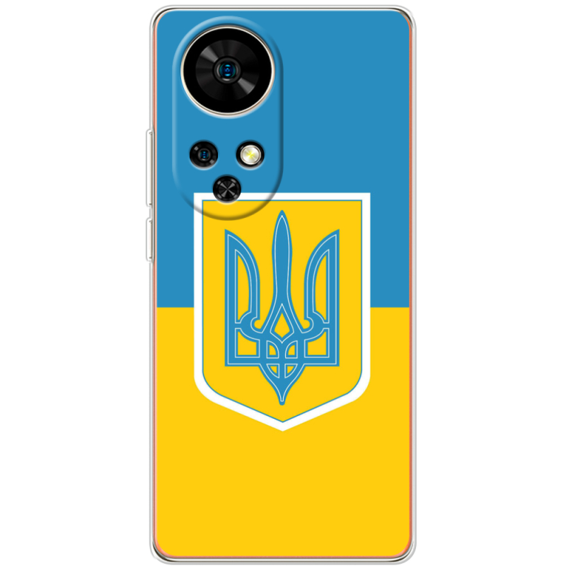 Чохол BoxFace Ulefone Note 17 Pro Герб України