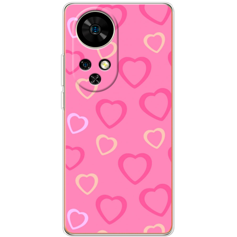 Чохол BoxFace Ulefone Note 17 Pro Sugar Hearts