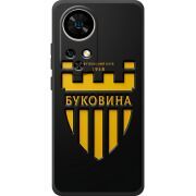 Чорний чохол BoxFace Ulefone Note 17 Pro 