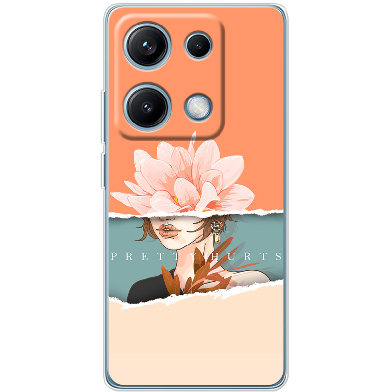 Чохол BoxFace Xiaomi Redmi Note 14S 