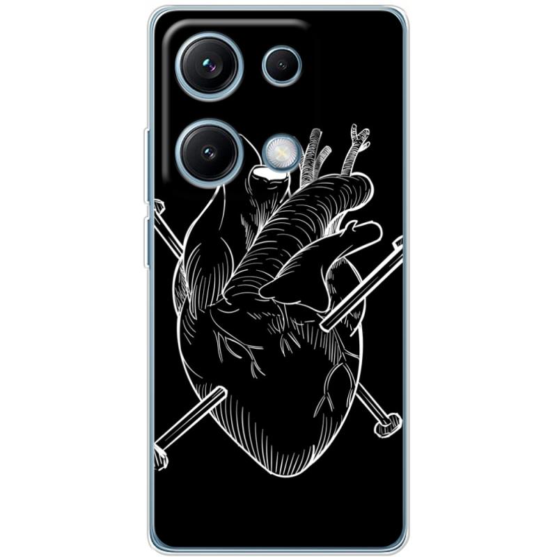 Чохол BoxFace Xiaomi Redmi Note 14S 