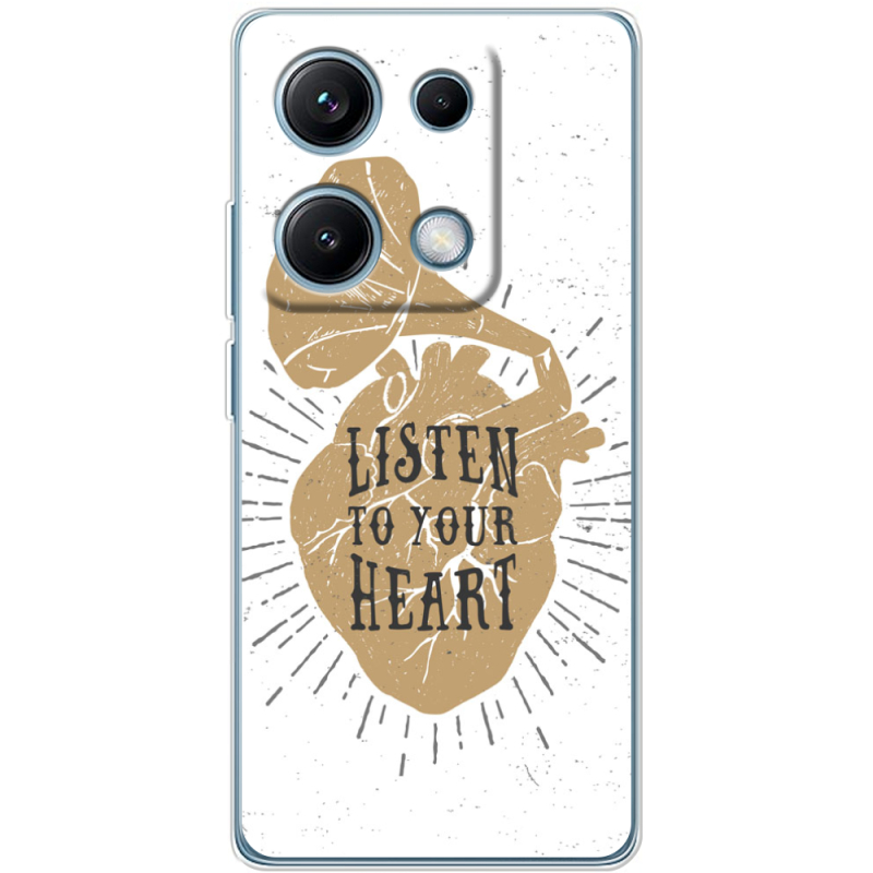 Чохол BoxFace Xiaomi Redmi Note 14S 