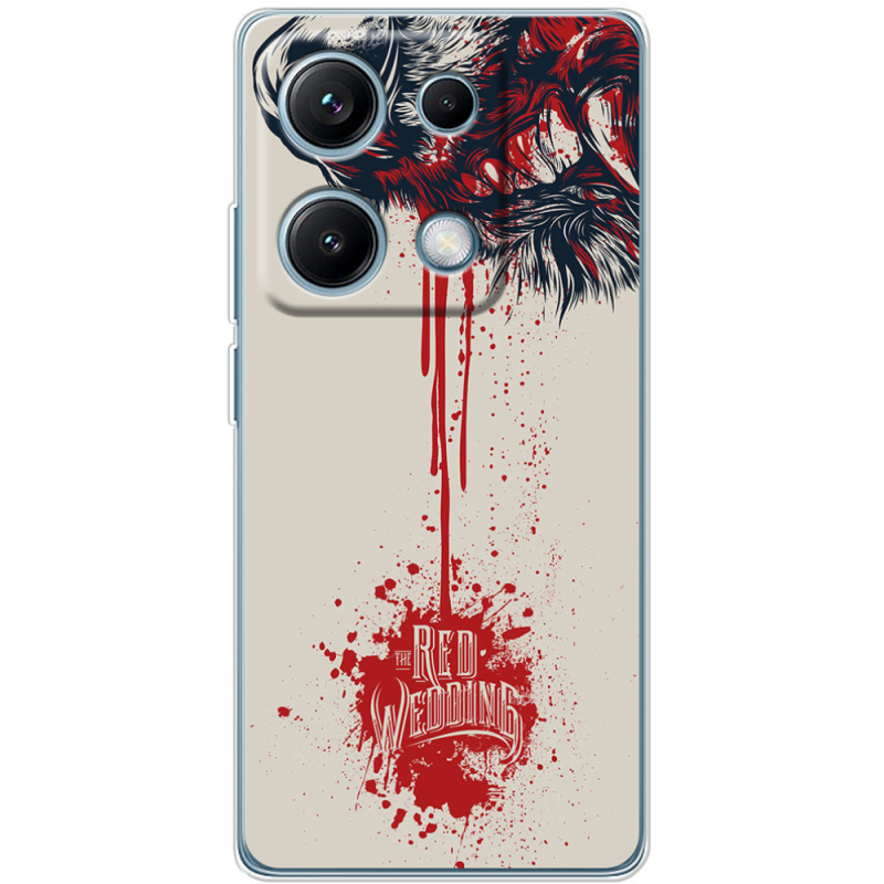 Чохол BoxFace Xiaomi Redmi Note 14S 