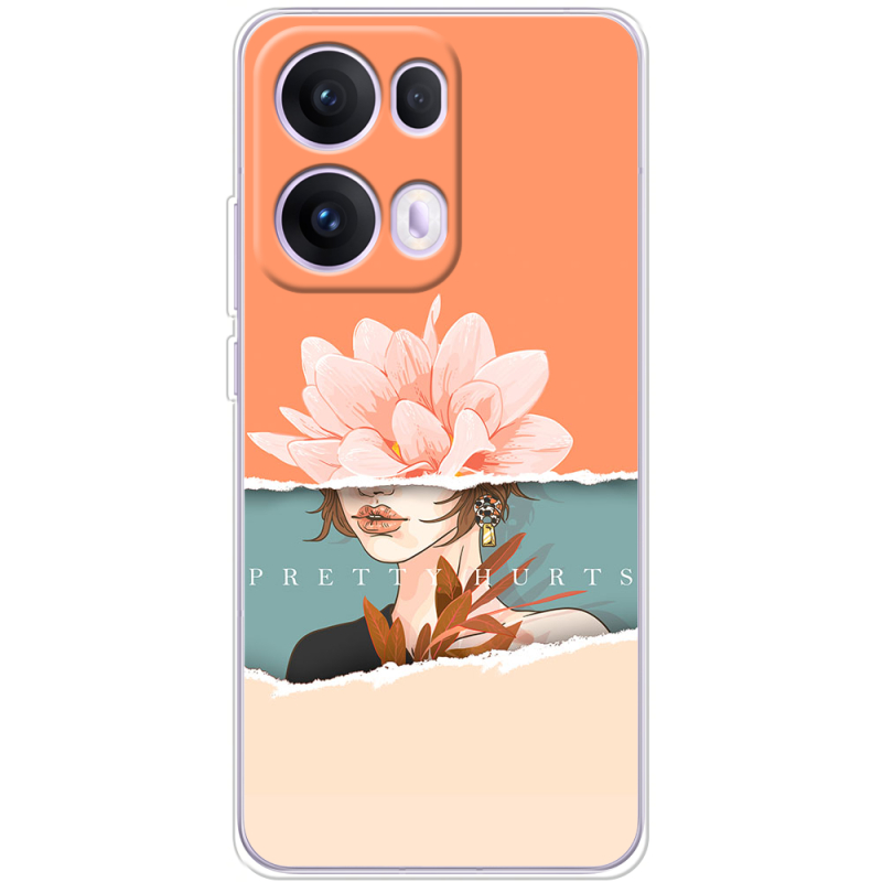 Чохол BoxFace OPPO Reno 13 Pro 5G 