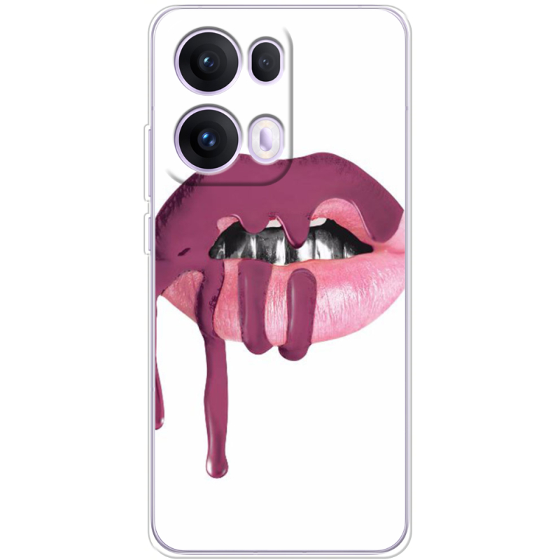 Чохол BoxFace OPPO Reno 13 Pro 5G 