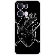 Чохол BoxFace OPPO Reno 13 Pro 5G 