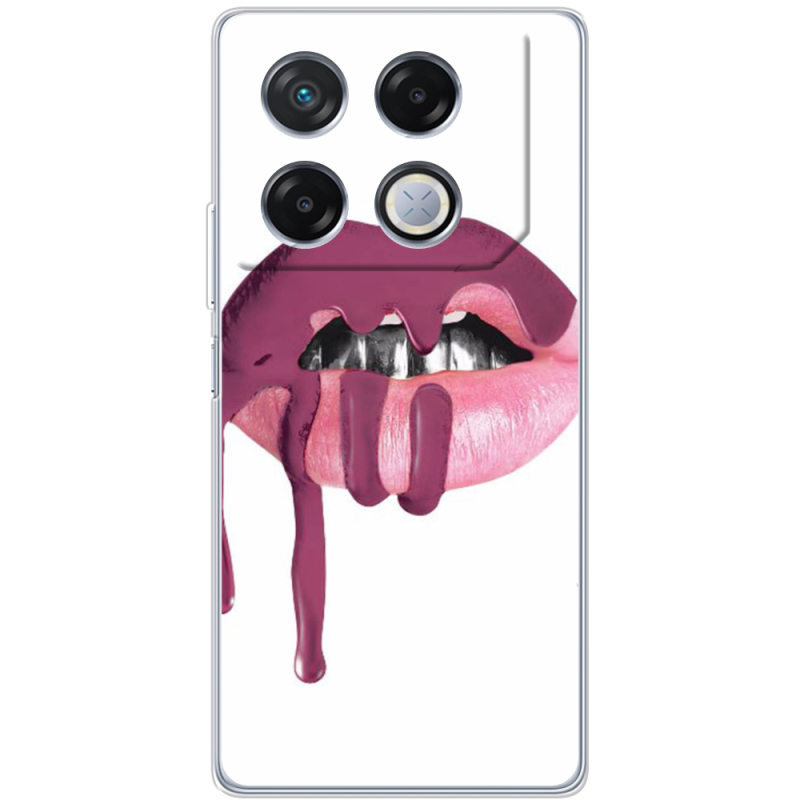 Чехол BoxFace Infinix GT 20 Pro 