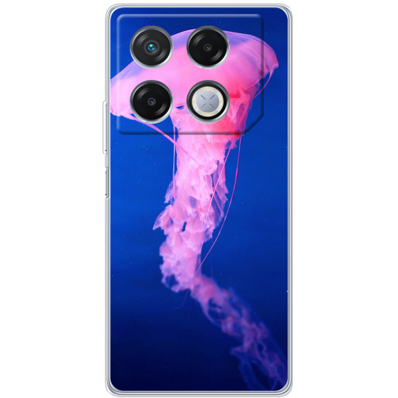 Чехол BoxFace Infinix GT 20 Pro 