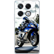 Чехол BoxFace Infinix GT 20 Pro 