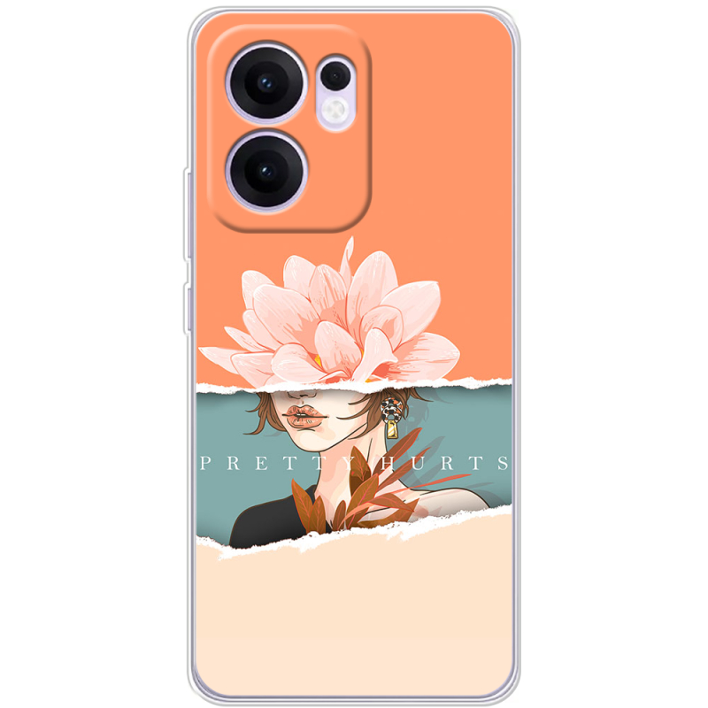 Чохол BoxFace OPPO Reno 13 FS 5G 