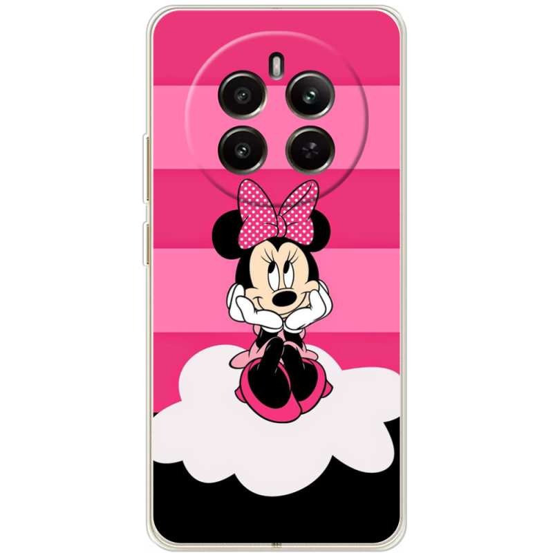 Чохол BoxFace Realme 12 4G 