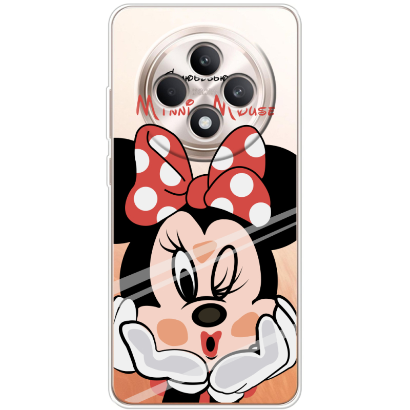 Прозорий чохол BoxFace OPPO Reno 12 FS Lady M
