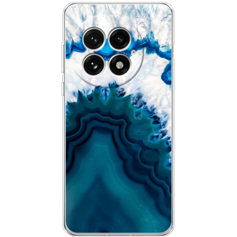 Чохол BoxFace OnePlus 13 
