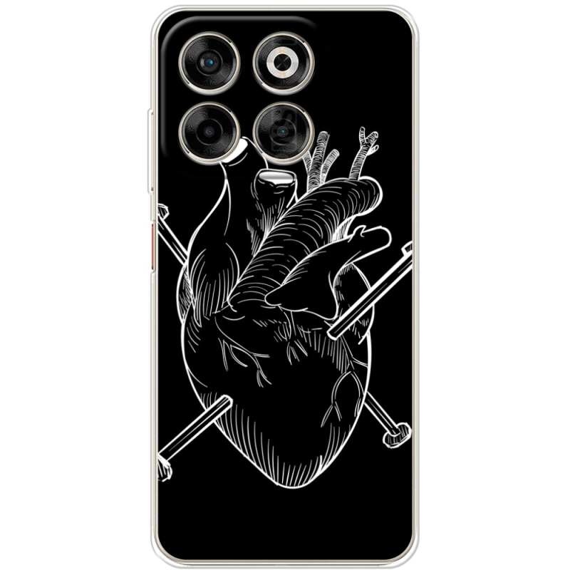 Чохол BoxFace Nubia V70 