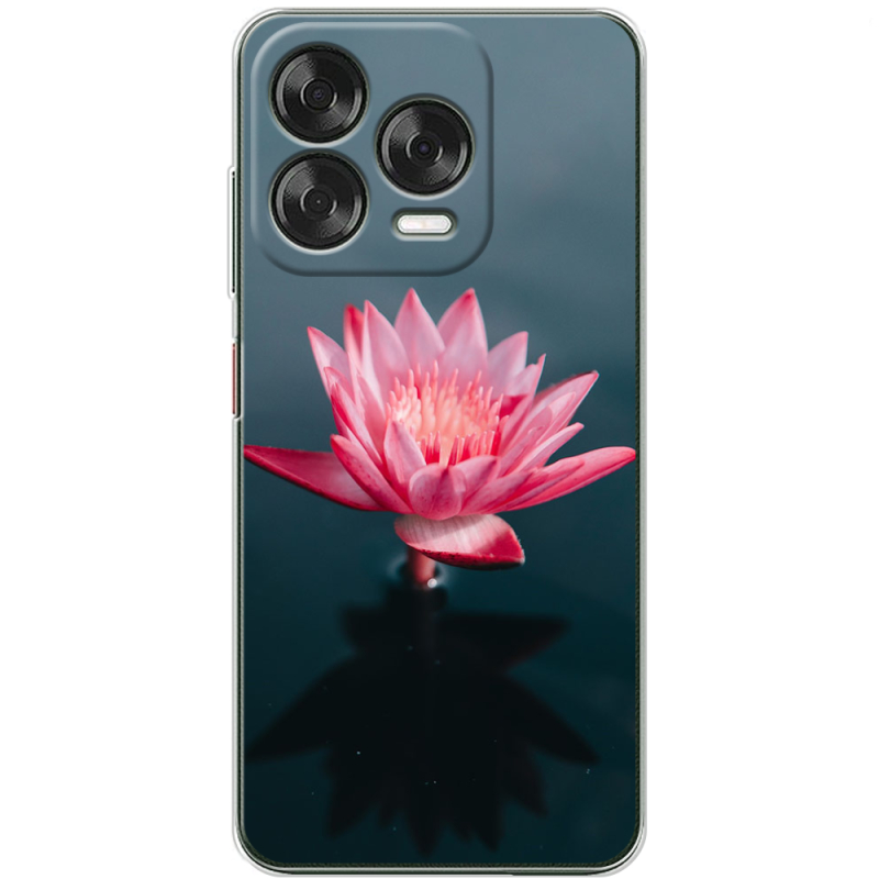 Чохол BoxFace Nubia V70 Design 