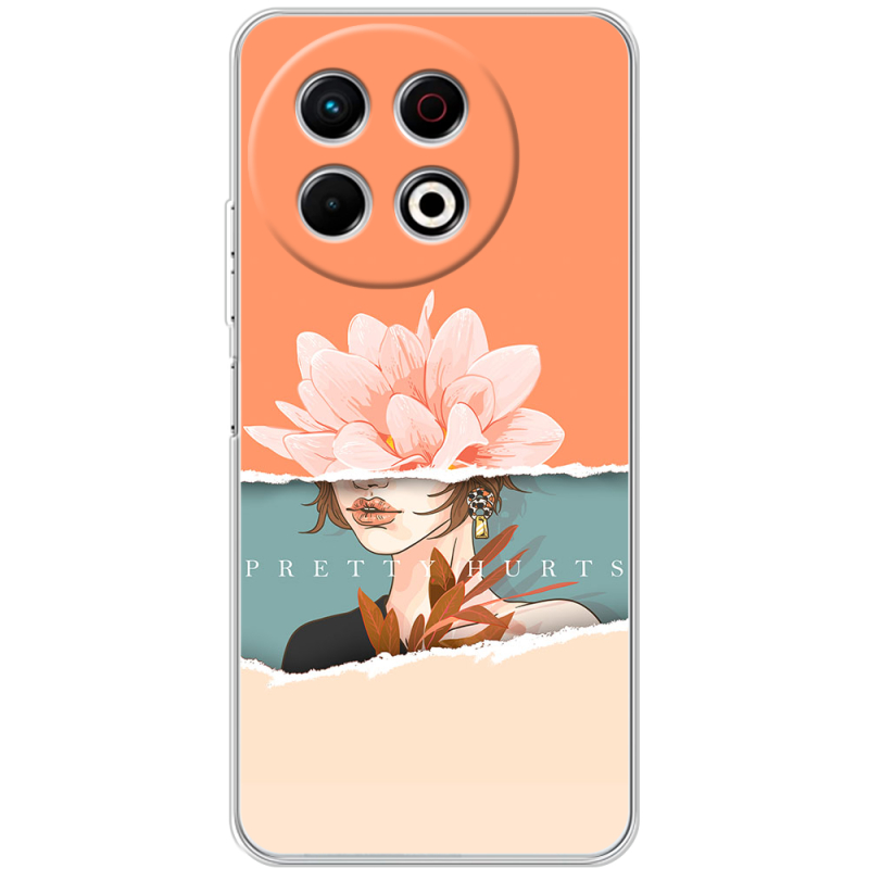 Чохол BoxFace Tecno Spark 30 Pro 4G 