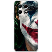Чохол BoxFace Tecno Spark 30 Pro 4G Joker Background