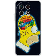 Чохол BoxFace Tecno Spark 30 Pro 4G 