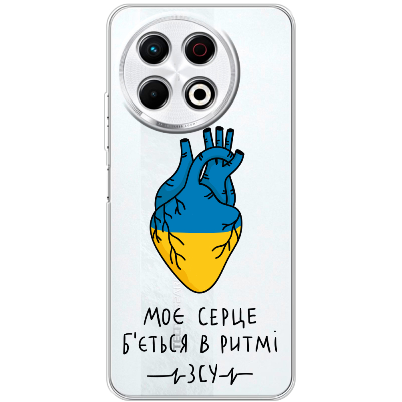 Прозорий чохол BoxFace Tecno Spark 30 Pro 4G Моє серце в ритмі ЗСУ