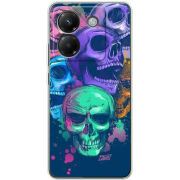 Чохол BoxFace Poco M7 Pro 5G 