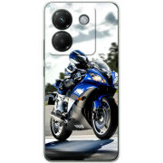 Чохол BoxFace Poco M7 Pro 5G 